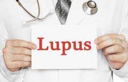 Lupus: symptômes et signaux d’alarme à ne jamais ignorer