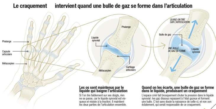 Les craquements articulaires - Actualités - Sante-dz