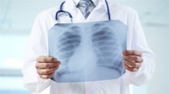 La tuberculose reste la principale cause infectieuse de mortalité dans le monde selon lOMS