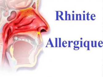 Rhinite allergique (Le rhume des foins)