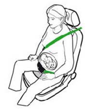 Ceinture De Sécurité Grossesse - Adaptateur Confort Pour Voiture - Protection Ventre Femmes Enceintes - Noir