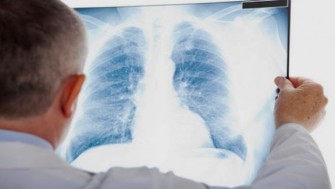 La tuberculose extra pulmonaire : prévention et traitement