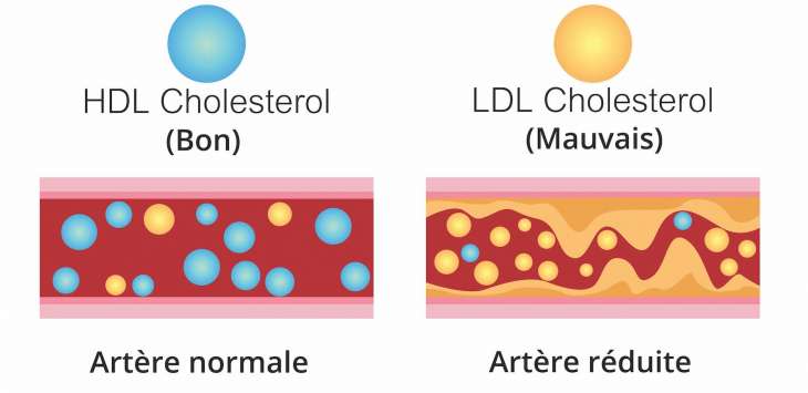 l’alimentation idéale pour avoir un taux de cholestérol à la norme