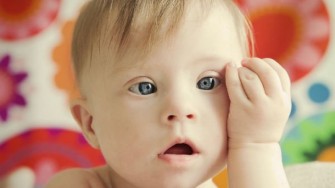 La Trisomie 21 Ou Mongolisme Un Chromosome En Plus Conseils Sante Dz